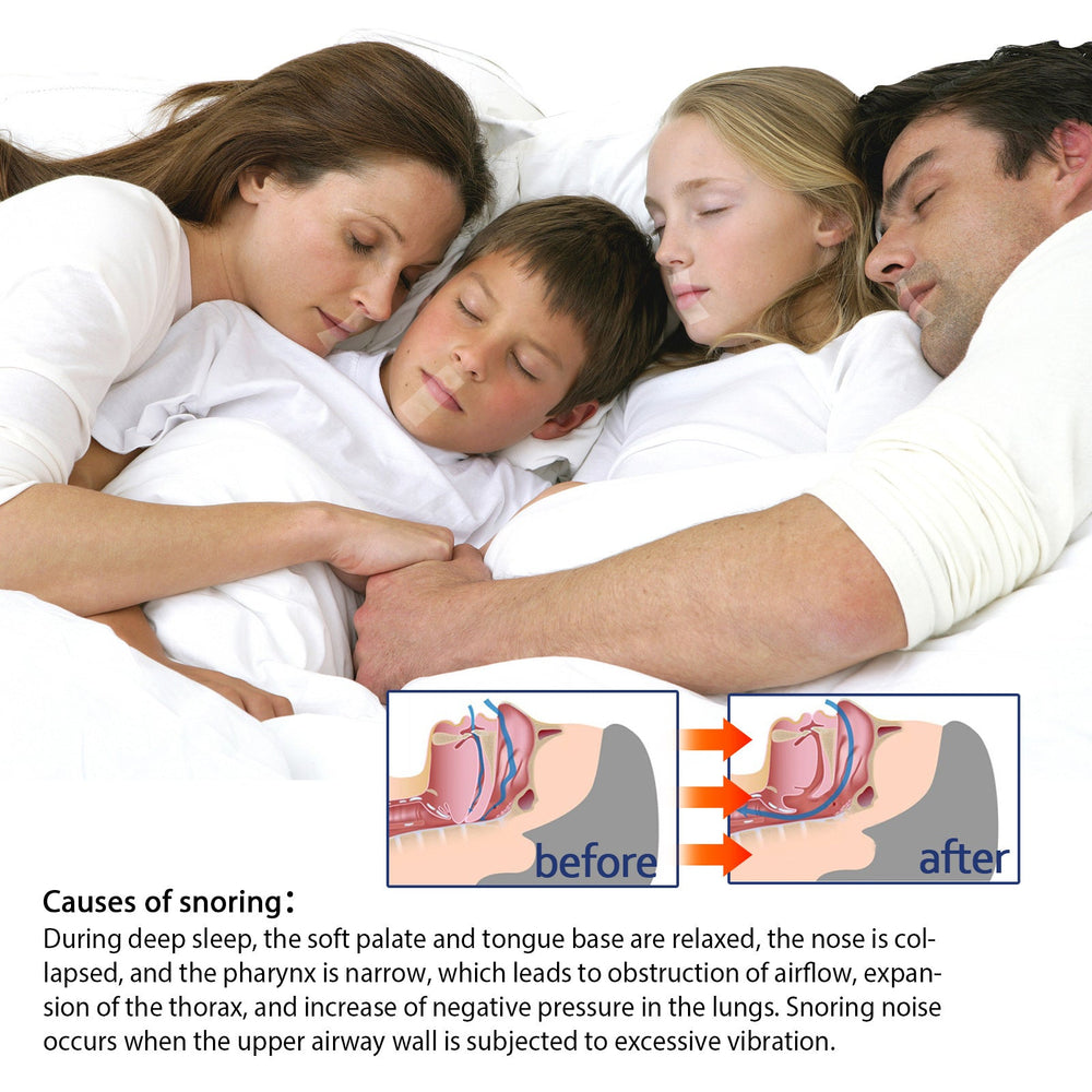 Anti-snoring Tape Anti-snoring Physical Expansion Nasal Sticker